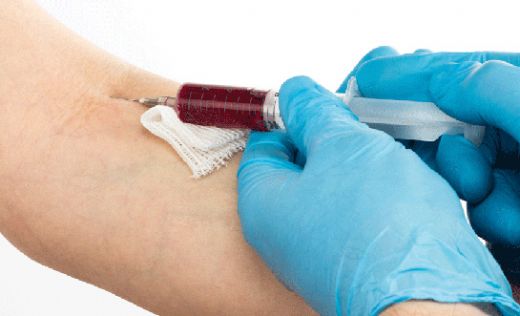 Akut Hepatit Nedir?
