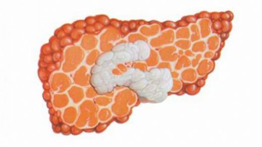 Kronik Hepatit Tanısı ve Tedavisi